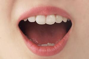 東京の最高技術アクアフィリングなら