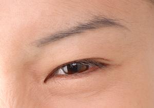 北海道の美容クリニックで叶える、自然な魅力アップ施術とは?